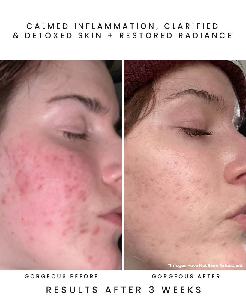 OBSCURA Night Repair Concentrate: Black Seaweed + Bakuchiol